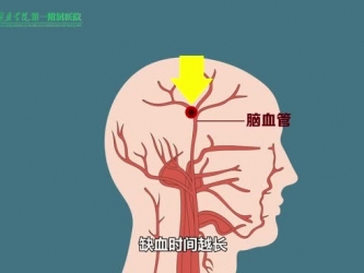 医院卒中中心动漫